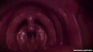Inside Clara's Throat [Eskoz]